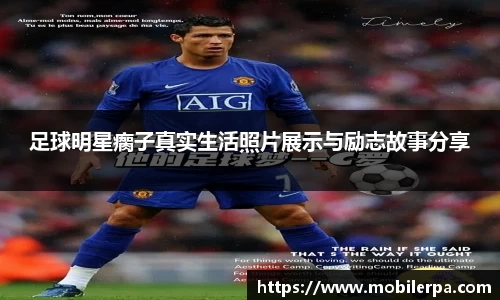 足球明星瘸子真实生活照片展示与励志故事分享